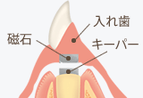 磁性アタッチメント