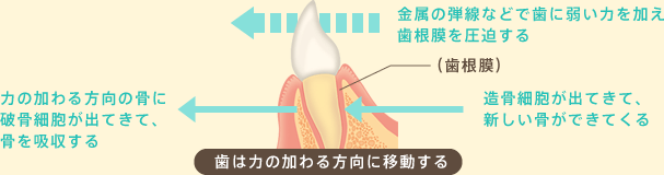 歯は力の加わる方向に移動する